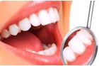 Снятие над и поддесневых отложений с зубов