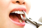 Удаление зуба однокорневого (подвижный)