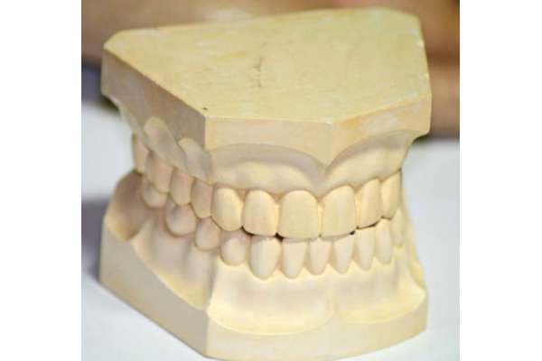Слепки зубов для протезирования