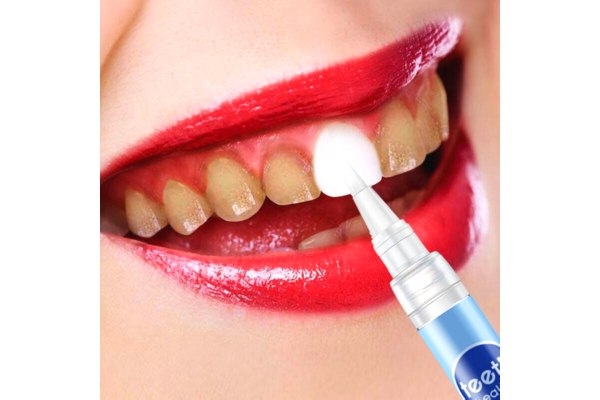 Гелевое отбеливание зубов (2 челюсти)