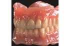 Полный зубной протез