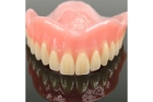 Зубной верхний протез