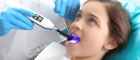 Удаление верхних молочных зубов