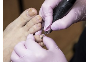 Лечение трещин ногтя
